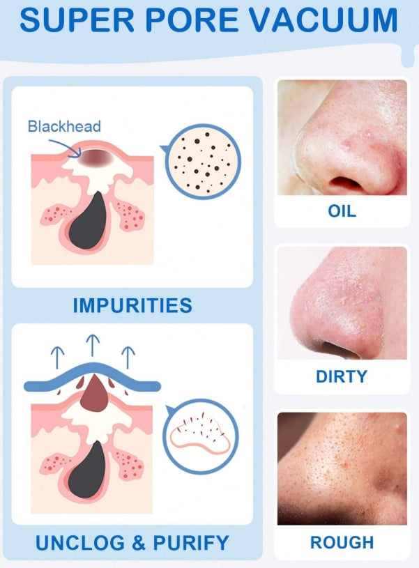 SlowSunday Blackhead Remover Nose Strips, Deep Cleanse and Refresh Your Skin, For Blackhead Removal