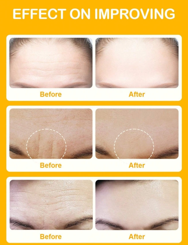 SlowSunday Niacinamide Forehead Patch 5 PCS
