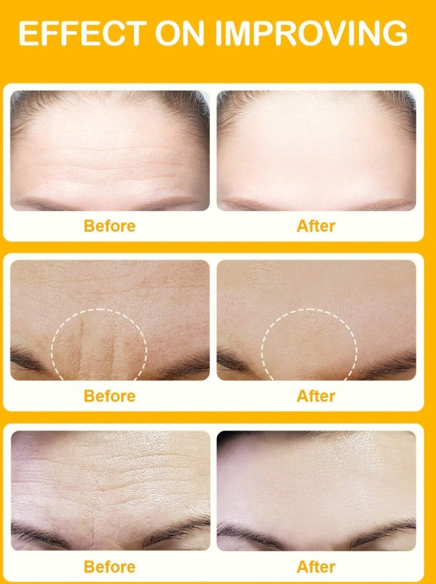 SlowSunday Niacinamide Forehead Patch