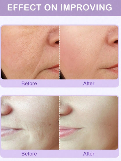 SlowSunday Face Fine Line Patches 5 PCS