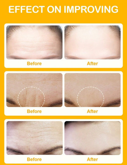 SlowSunday Niacinamide Forehead Patch 5 PCS